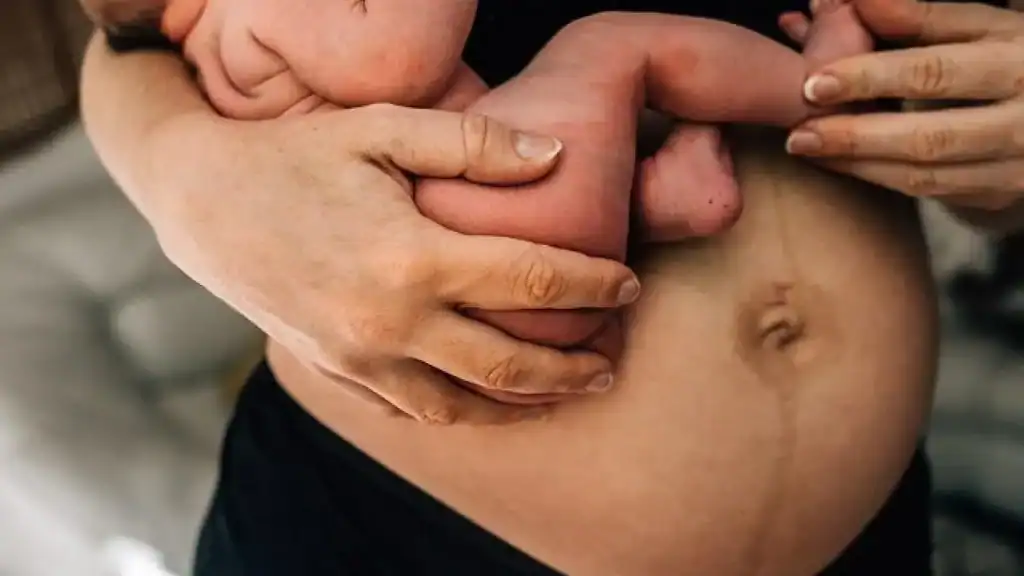 Why Is My Stomach Still Big After Pregnancy Bolton?